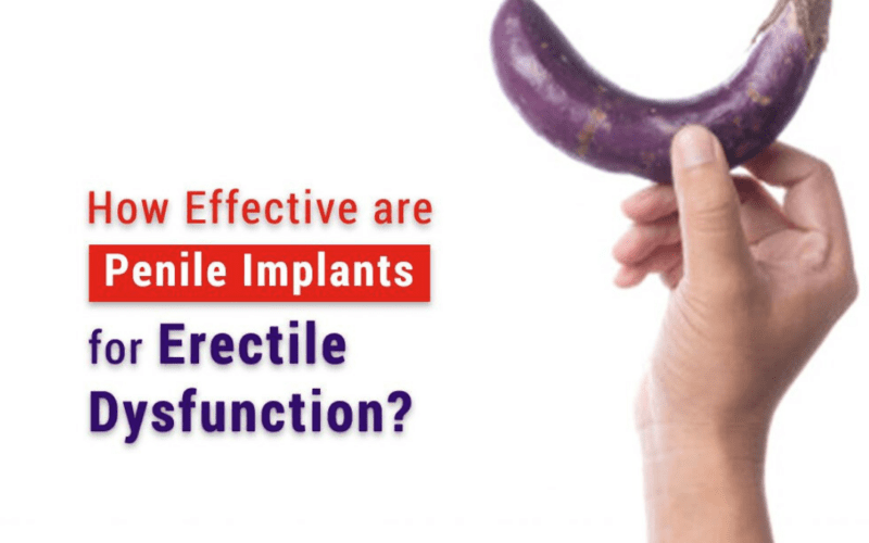 Penile Implants: Trends, Treatment, Costs, and Benefits