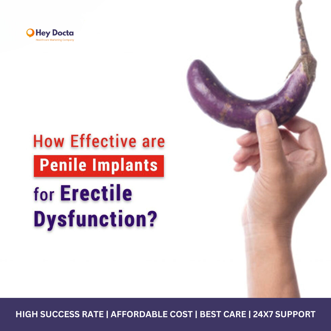 Penile Implants: Trends, Treatment, Costs, and Benefits