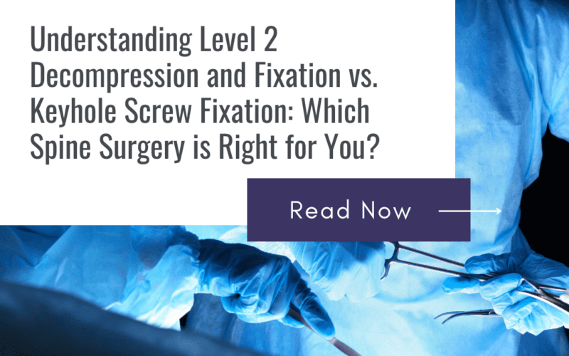 Level 2 Decompression and Fixation vs. Keyhole Screw Fixation