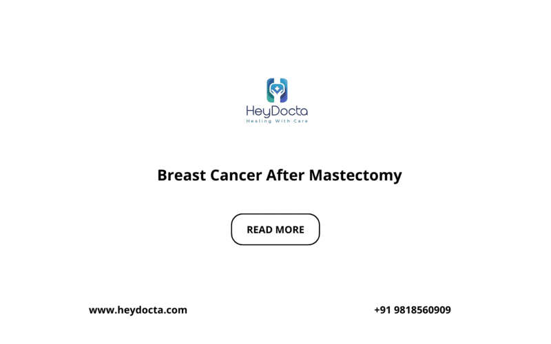Breast Cancer After Mastectomy