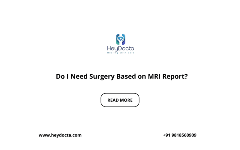 Do I Need Surgery Based on MRI Report?