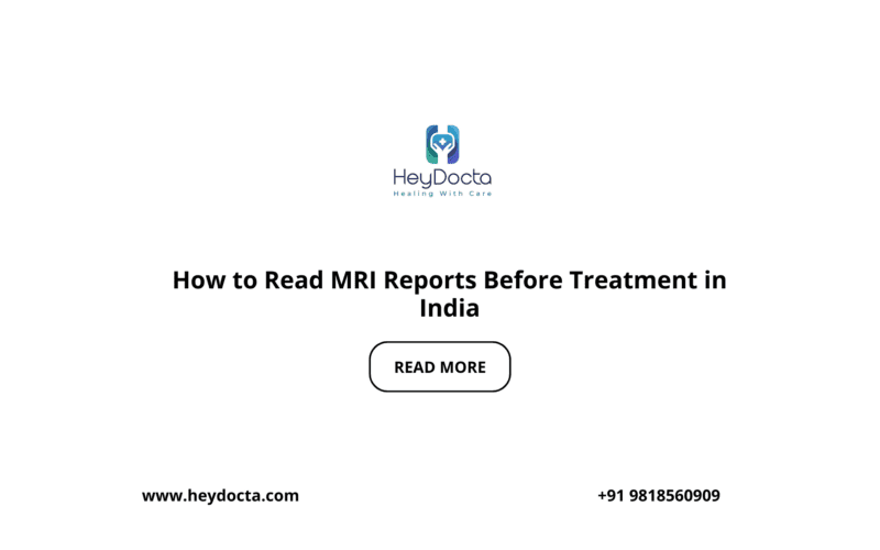 How to Read MRI Reports Before Treatment in India