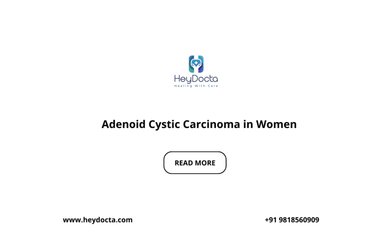 Adenoid Cystic Carcinoma in Women