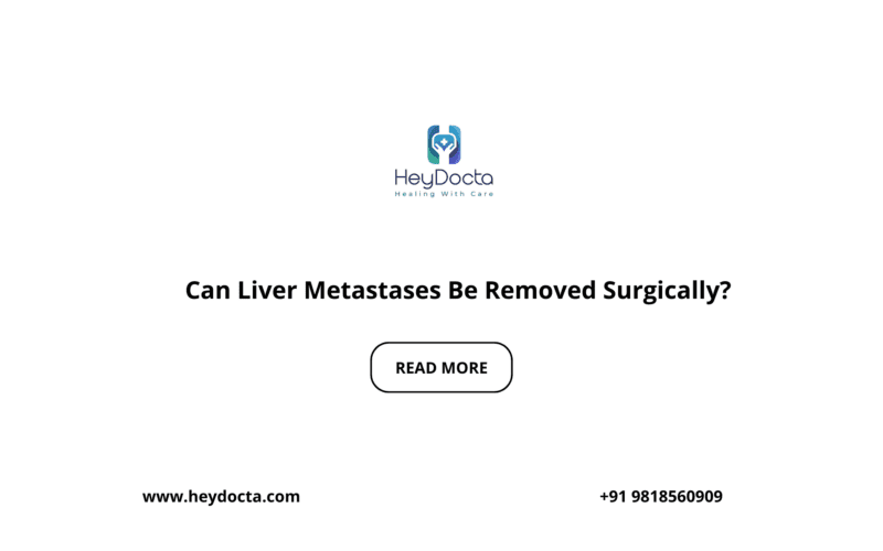 Can Liver Metastases Be Removed Surgically?