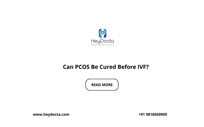 Can PCOS Be Cured Before IVF?