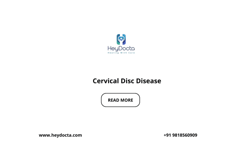 Cervical Disc Disease