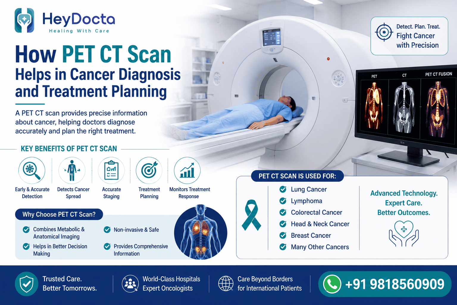 How PET CT Scan Helps in Cancer Diagnosis and Treatment Planning