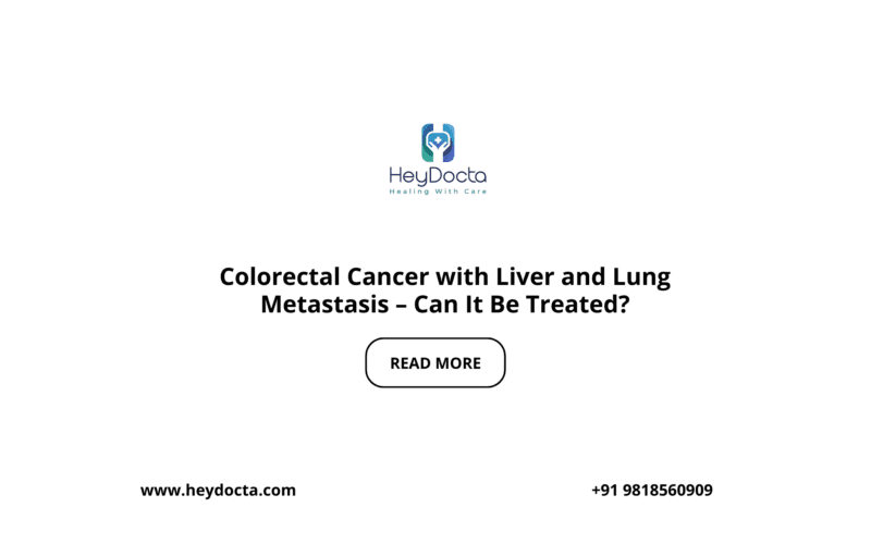 Colorectal Cancer with Liver and Lung Metastasis – Can It Be Treated?