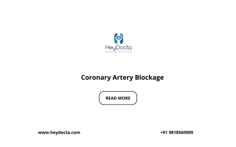 Coronary Artery Blockage