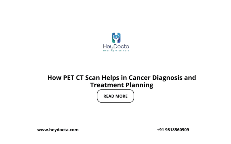 How PET CT Scan Helps in Cancer Diagnosis and Treatment Planning
