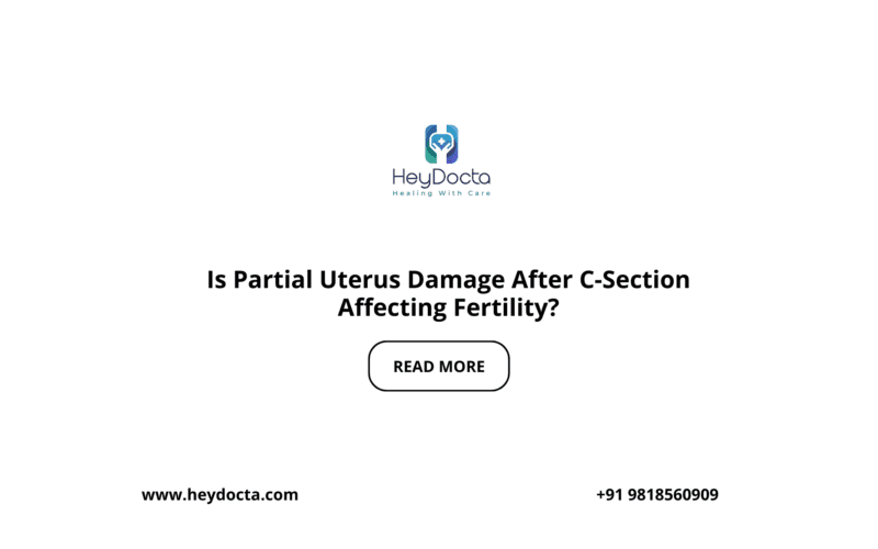 Is Partial Uterus Damage After C-Section Affecting Fertility?