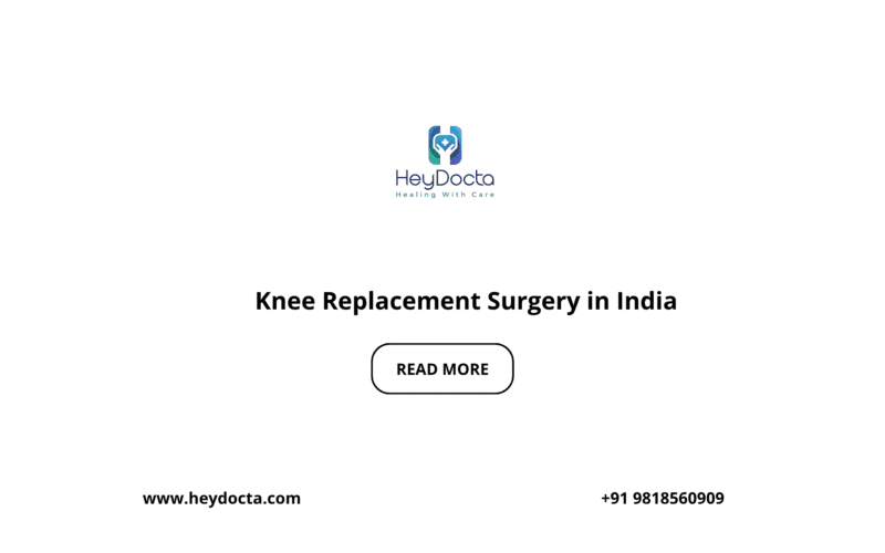 Knee Replacement Surgery in India