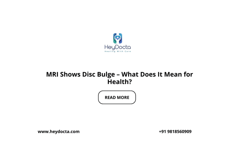 MRI Shows Disc Bulge – What Does It Mean for  Health?