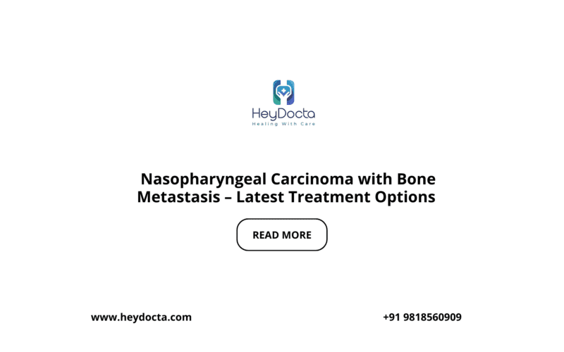 Nasopharyngeal Carcinoma with Bone Metastasis – Latest Treatment Options