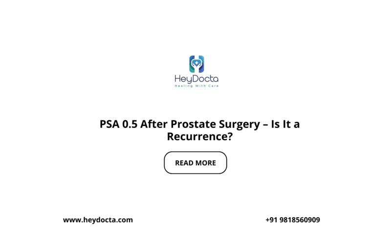 PSA 0.5 After Prostate Surgery – Is It a Recurrence?
