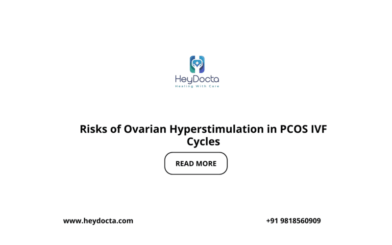 Risks of Ovarian Hyperstimulation in PCOS IVF Cycles