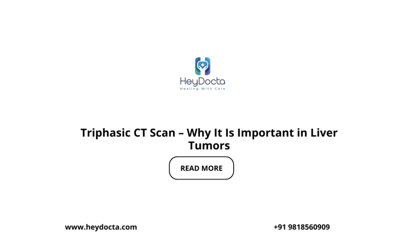 Triphasic CT Scan – Why It Is Important in Liver Tumors