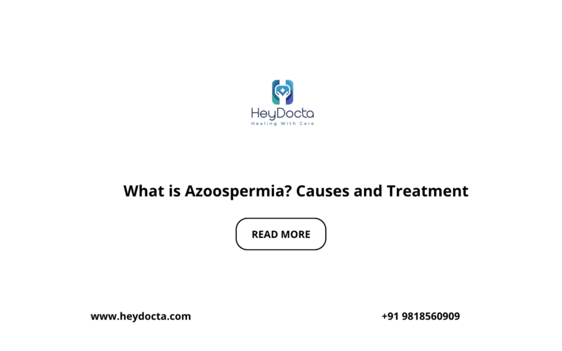 What is Azoospermia? Causes and Treatment