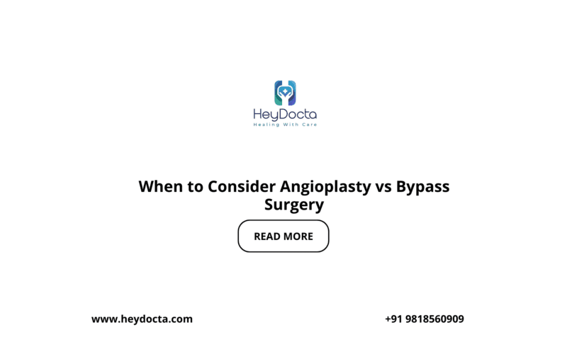 When to Consider Angioplasty vs Bypass Surgery