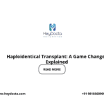 Haploidentical Transplant: A Game Changer Explained