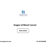 Stages of Blood Cancer