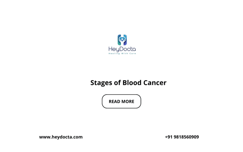 Stages of Blood Cancer