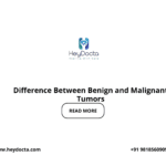 Difference Between Benign and Malignant Tumors
