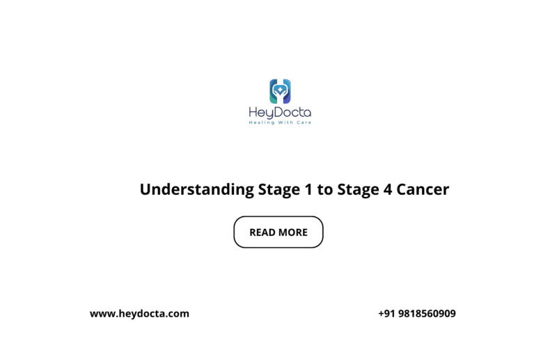 Understanding Stage 1 to Stage 4 Cancer