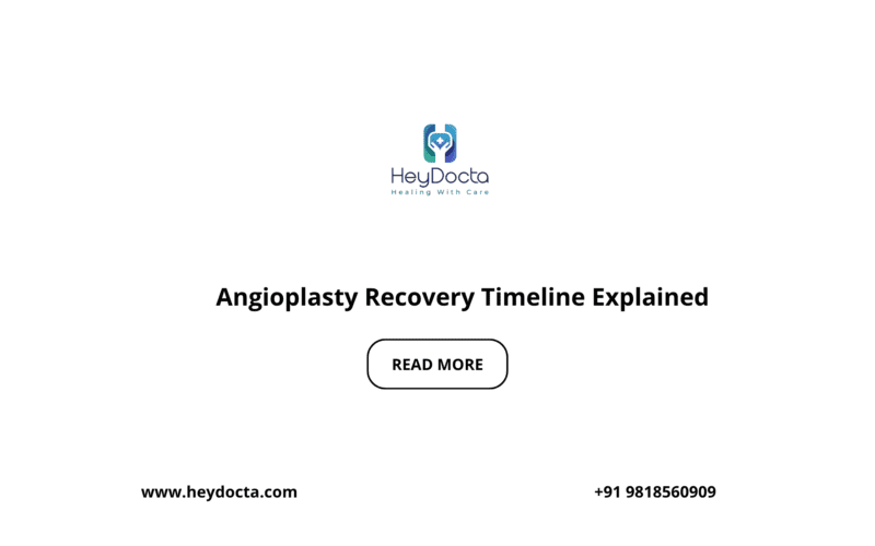 Angioplasty Recovery Timeline Explained