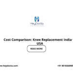 Cost Comparison: Knee Replacement India vs USA
