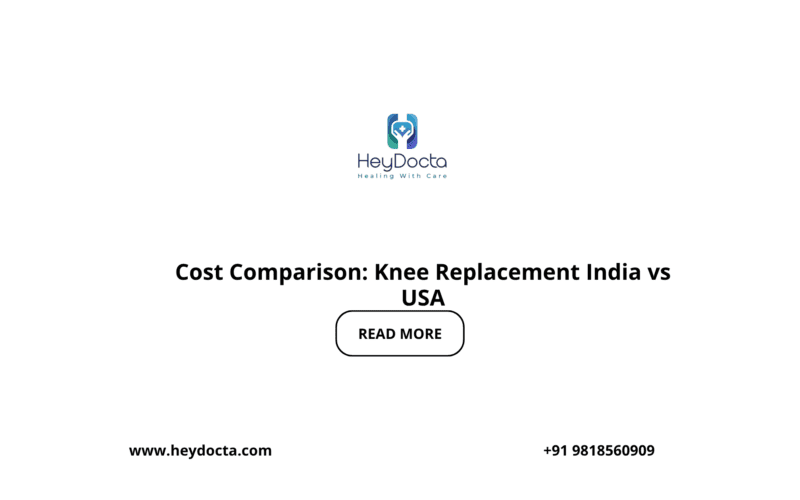 Cost Comparison: Knee Replacement India vs USA