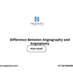 Difference Between Angiography and Angioplasty