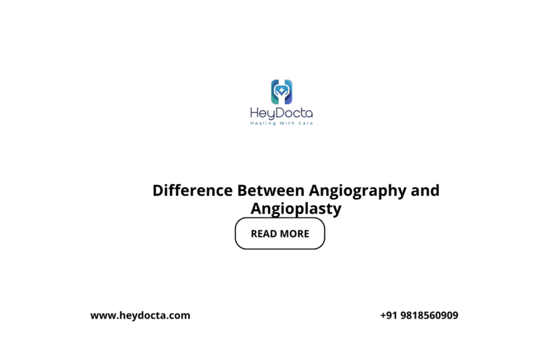 Difference Between Angiography and Angioplasty