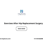 Exercises After Hip Replacement Surgery
