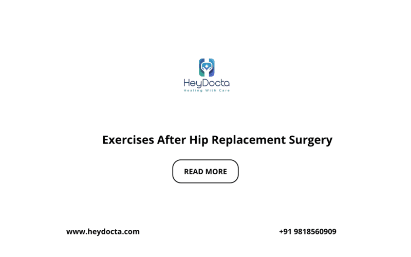 Exercises After Hip Replacement Surgery