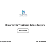 Hip Arthritis Treatment Before Surgery