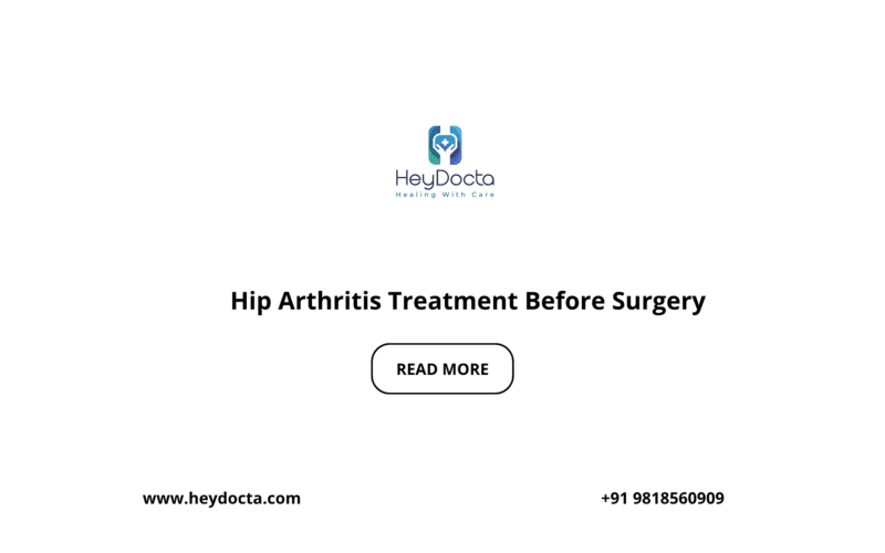 Hip Arthritis Treatment Before Surgery