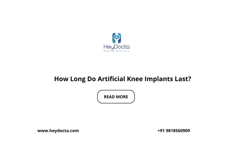 How Long Do Artificial Knee Implants Last?