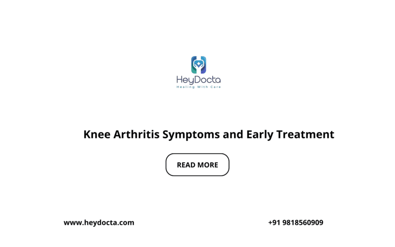 Knee Arthritis Symptoms and Early Treatment