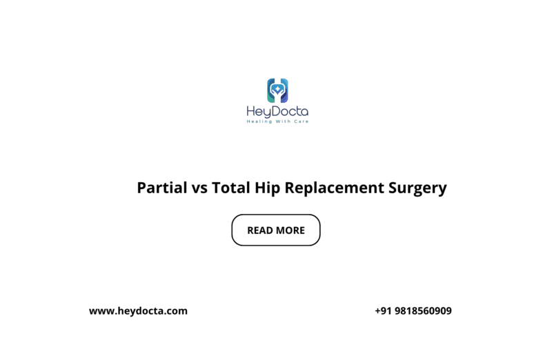 Partial vs Total Hip Replacement Surgery