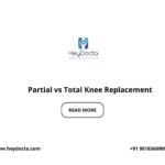 Partial vs Total Knee Replacement