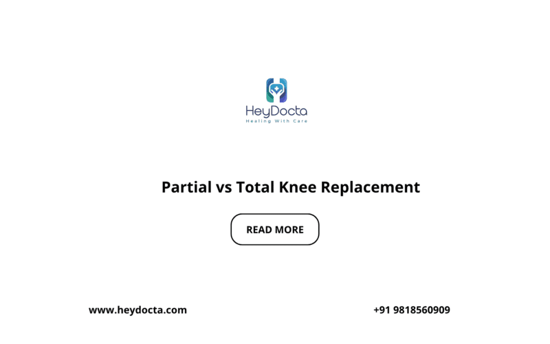 Partial vs Total Knee Replacement