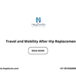 Travel and Mobility After Hip Replacement