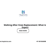 Walking After Knee Replacement: What to Expect
