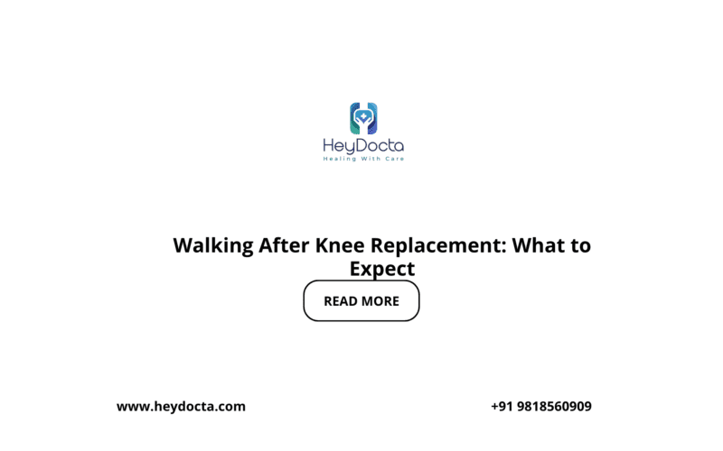 Walking After Knee Replacement: What to Expect