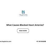 What Causes Blocked Heart Arteries?