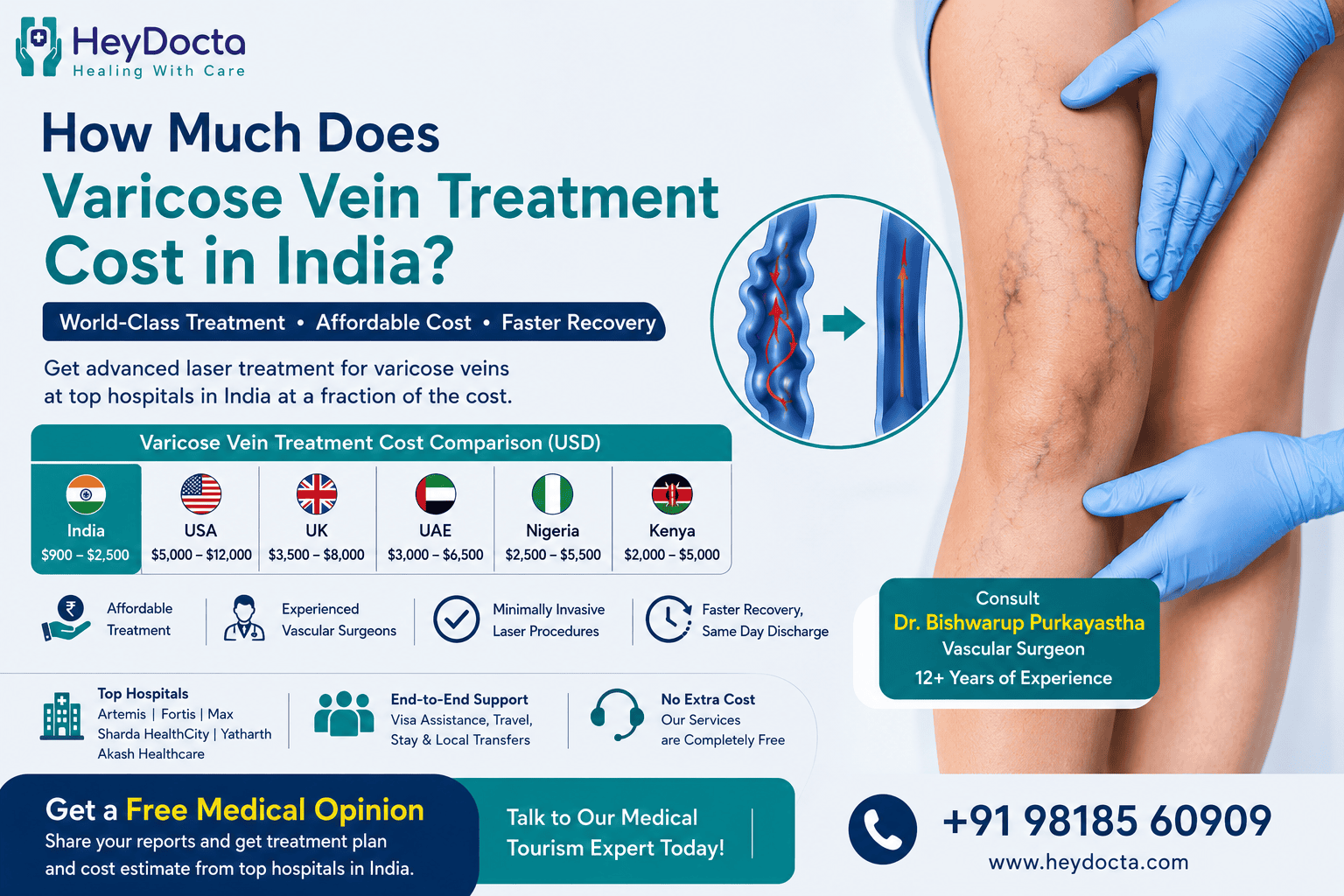 How Much Does Varicose Vein Treatment Cost in India?