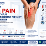 Is Your Leg Pain More Than Just Varicose Veins?
