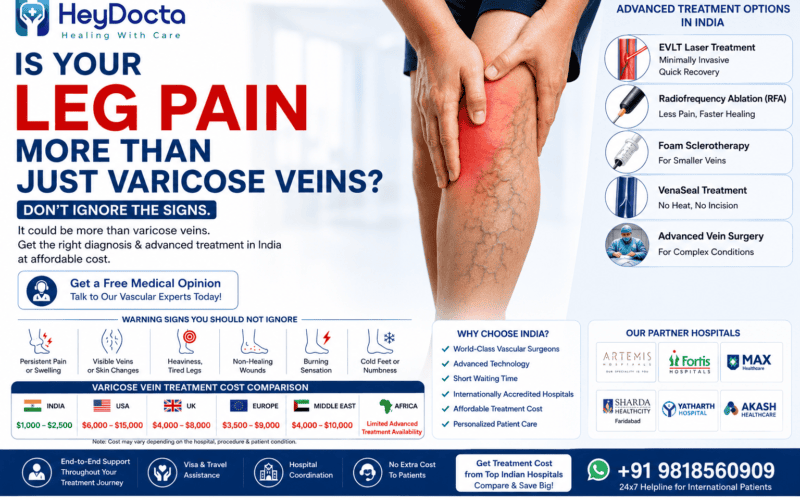 Is Your Leg Pain More Than Just Varicose Veins?