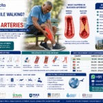 Leg Pain While Walking? It Could Be Blocked Arteries